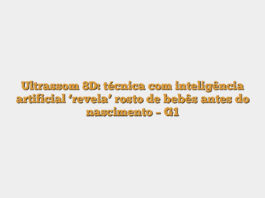 Ultrassom 8D: técnica com inteligência artificial ‘revela’ rosto de bebês antes do nascimento – G1
